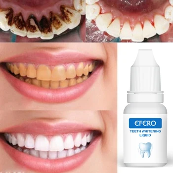 3PCS Beljenje Zob Gel, Serum Zobni Učinkovito Odstranjevanje Madežev Plaketo Zob Čiščenje Bistvo Ustno Higieno Zobna Nega zobna pasta